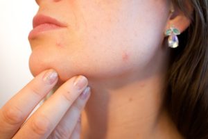 Your Skin Problems