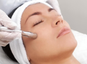 lady, acne treatment